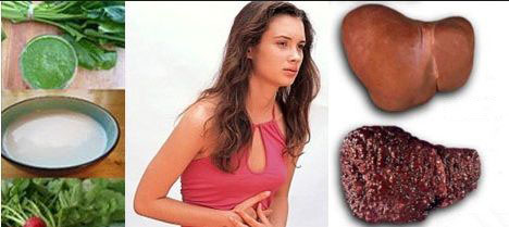 цирроз печени у женщин фото