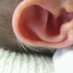 инфекция уха у детей фото