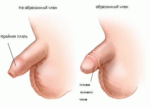 фото до обрезания и после 